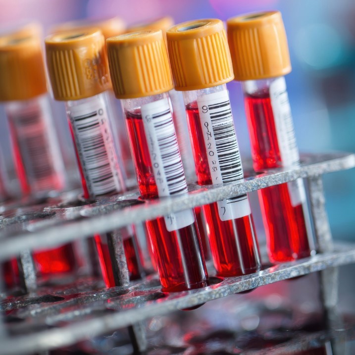 blood sample tubes